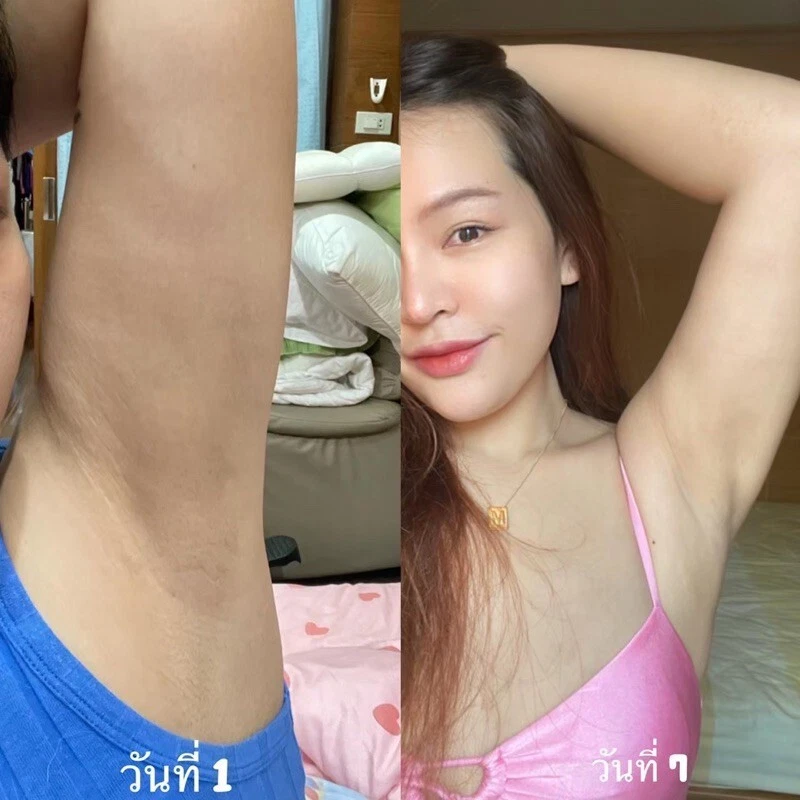 2x Congrats Good Skin Vitamin Body Cream Armpits Brightening Reduce Odor 50 g