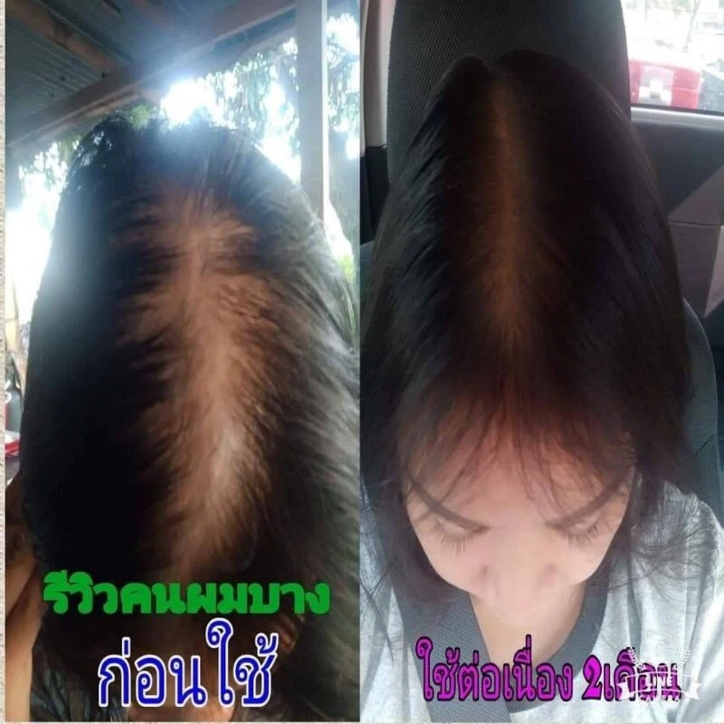 2x Legano Hair Tonic Extra Prevent Loss Treatment Natural Herb Fast Growth 120ml