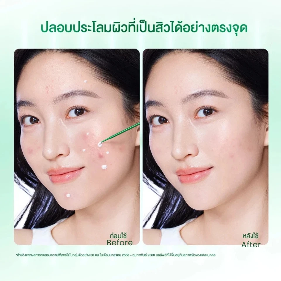 2x SKINTIFIC Acne Drying Lotion Salicylic Acid Acne Spot Treatment BHA 10ml