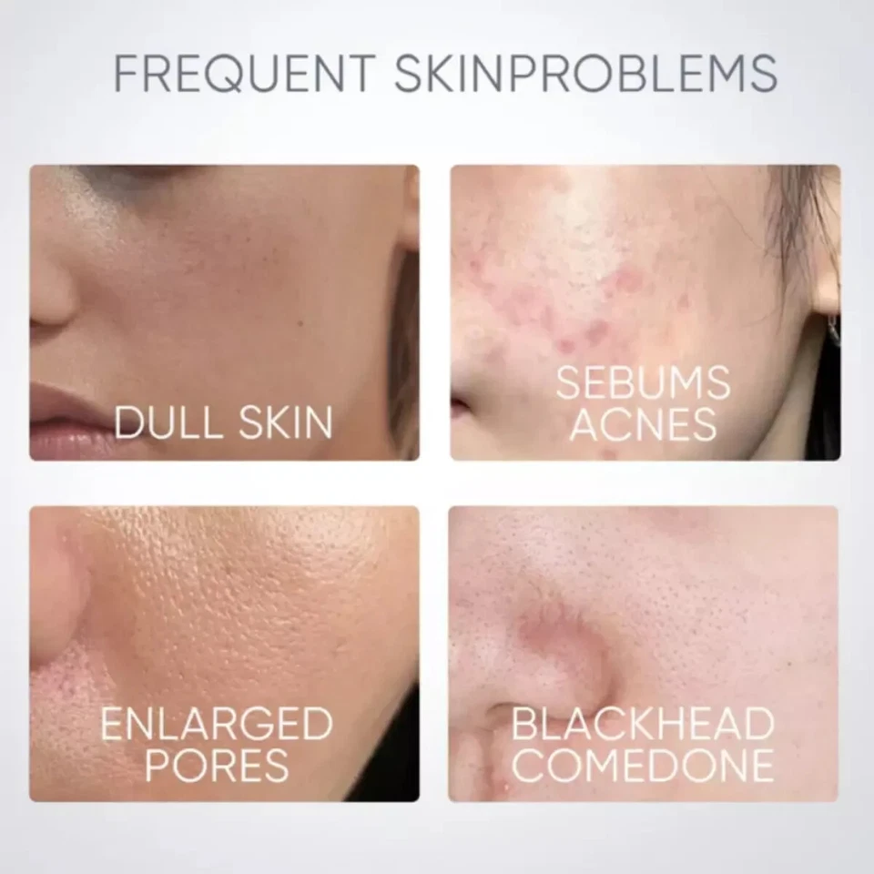 2 x SKINTIFIC Alaska Volcano Clay Mask Glycolic Detox Skin Clean Pores Blackhead