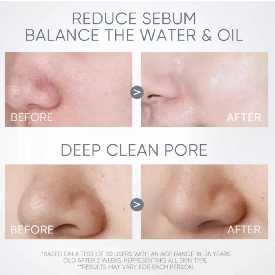 2 x SKINTIFIC Alaska Volcano Clay Mask Glycolic Detox Skin Clean Pores Blackhead