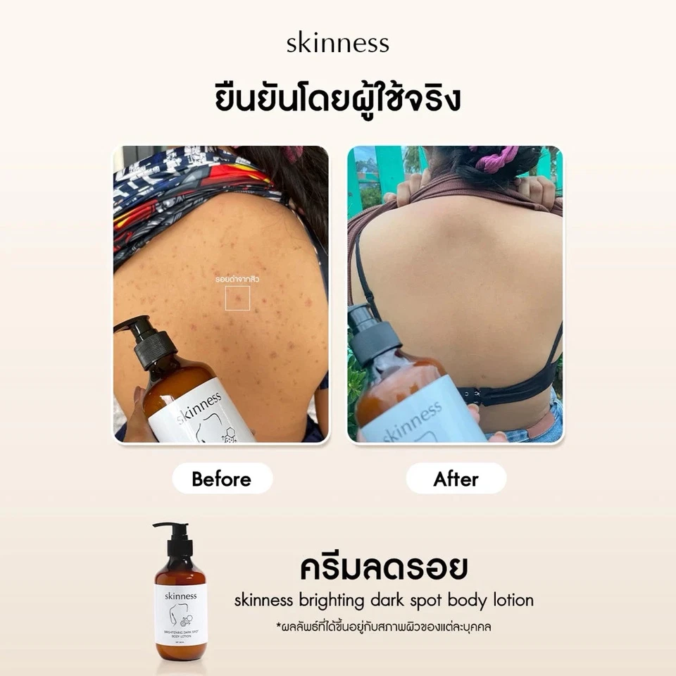 2x skinness brightening dark spot body lotion Body cream reduce scars bright