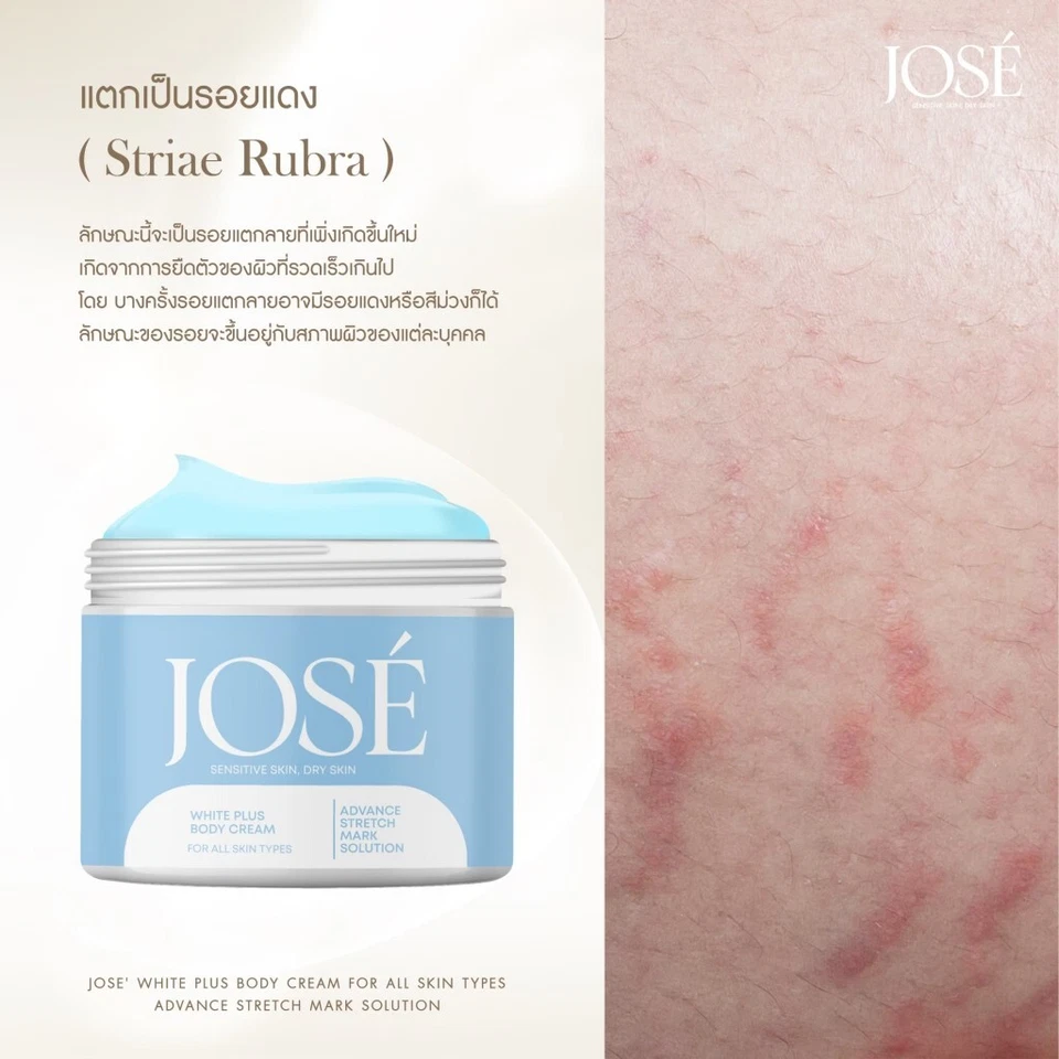 3x Jose White Plus Body Cream lotion for smooth stomach skin care mother's cream